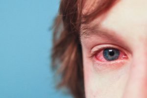 Allergies eyes child mold panama